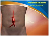 Abdominal Aneurysm Editable Template