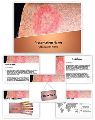 Lyme Disease Editable PowerPoint Template