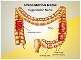 Digestive Colon Pathologies Editable PowerPoint Template