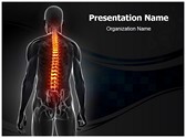 Osteoporosis Editable PowerPoint Template