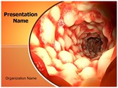 Inflammatory Bowel Editable PowerPoint Template