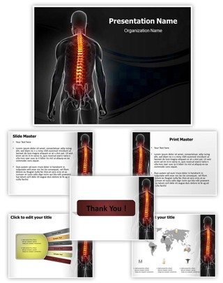 Osteoporosis Editable PowerPoint Template