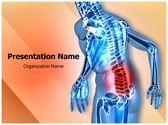 Back Pain Editable PowerPoint Template