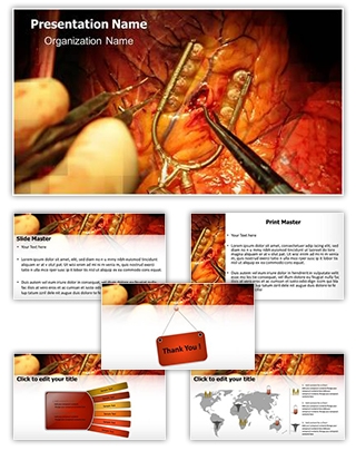 Bypass Surgery Editable PowerPoint Template