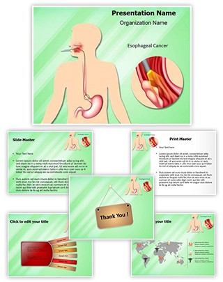 Esophageal Cancer Editable PowerPoint Template