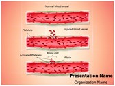 Blood Clotting Process Template