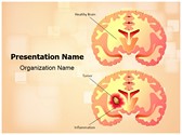 Brain Tumor PowerPoint Templates