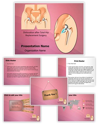 Hip Replacement Surgery Dislocation Editable PowerPoint Template