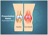 Hemophilia Joint Bleeding Editable PowerPoint Template