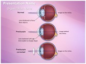 Optometrist Presbyopia Editable PowerPoint Template