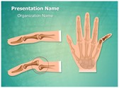 Orthopedic Finger Dislocation Editable PowerPoint Template