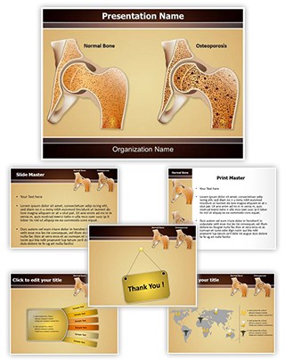 Osteopathy Osteoporosis Editable PowerPoint Template