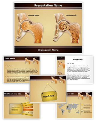 Osteopathy Osteoporosis