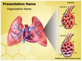 Pulmonary Edema Template