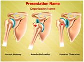 Shoulder Dislocation Editable PowerPoint Template