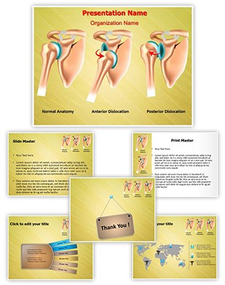 Shoulder Dislocation Editable PowerPoint Template