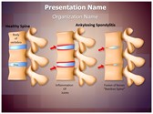 Spine Ankylosing Spondylitis
