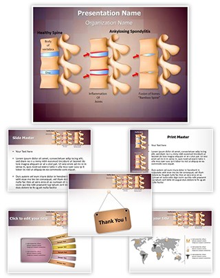 Spine Ankylosing Spondylitis Editable PowerPoint Template