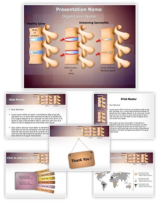 Spine Ankylosing Spondylitis