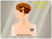 Vagus Nerve Stimulation