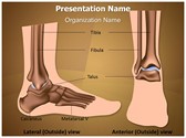 Metatarsal Ankle Joint Editable Template