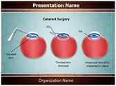 Ophthalmology Cataract Surgery Editable PowerPoint Template