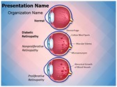 Retinopathy Diabetic Retinopathy Editable PowerPoint Template