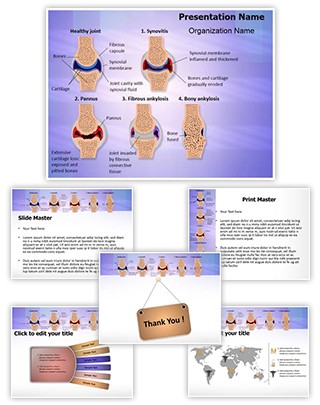 Synovial Rheumatoid Arthritis Stages Editable PowerPoint Template