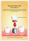 Dental Crown Procedure Editable Template