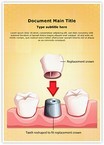 Dental Crown Procedure