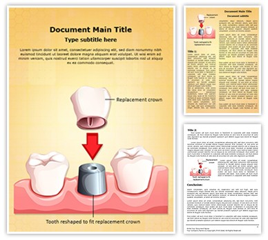 Dental Crown Procedure Editable Word Template