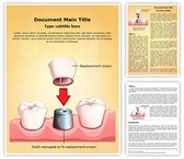 Dental Crown Procedure