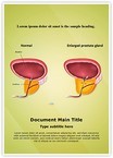 Benign Prostatic Hyperplasia Editable Template