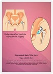Hip Replacement Surgery Dislocation Editable Template