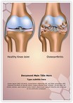 Knee Joint Osteoarthritis Editable Template