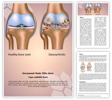 Knee Joint Osteoarthritis Editable Word Template