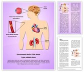 Complications of hypertension Editable PowerPoint Template