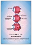 Retinopathy Diabetic Retinopathy Editable Template