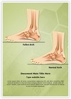 Pes Planus Flat Foot