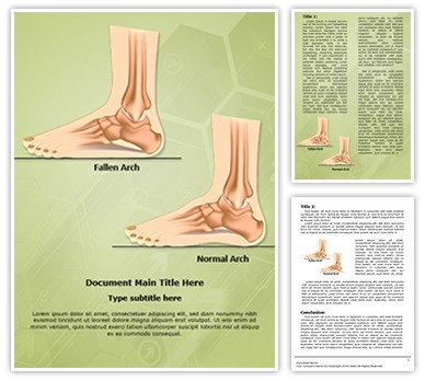 Pes Planus Flat Foot Editable Word Template