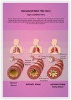 Illustration Pathology of Asthma Editable Template