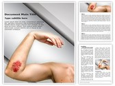 Abrasion Editable PowerPoint Template