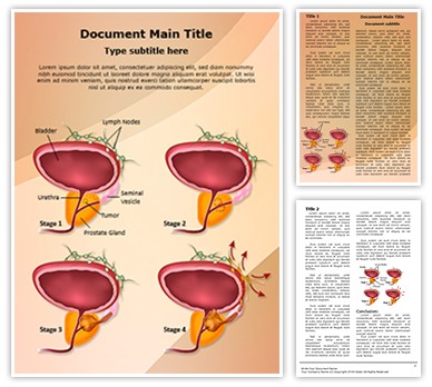 Prostate Cancer Stages Editable Word Template