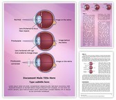 Optometrist Presbyopia Editable PowerPoint Template