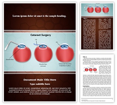 Ophthalmology Cataract Surgery Editable Word Template