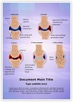 Synovial Rheumatoid Arthritis Stages Editable Template