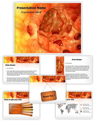 Diverticulosis Editable PowerPoint Template