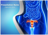 Painful Uterus Editable PowerPoint Template