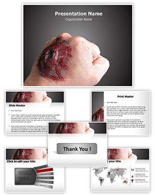 Burned Hand Editable PowerPoint Template