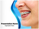 Braces Editable PowerPoint Template